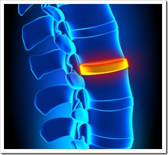 Herniated Disc and Back Pain Chester VA