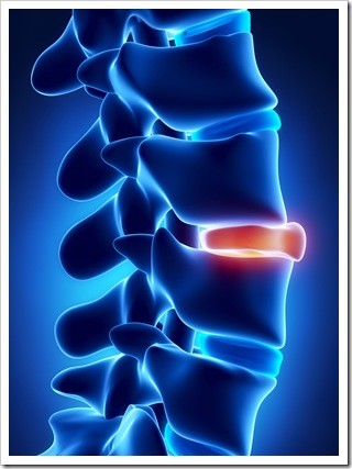 Slipped Disc Chester VA
