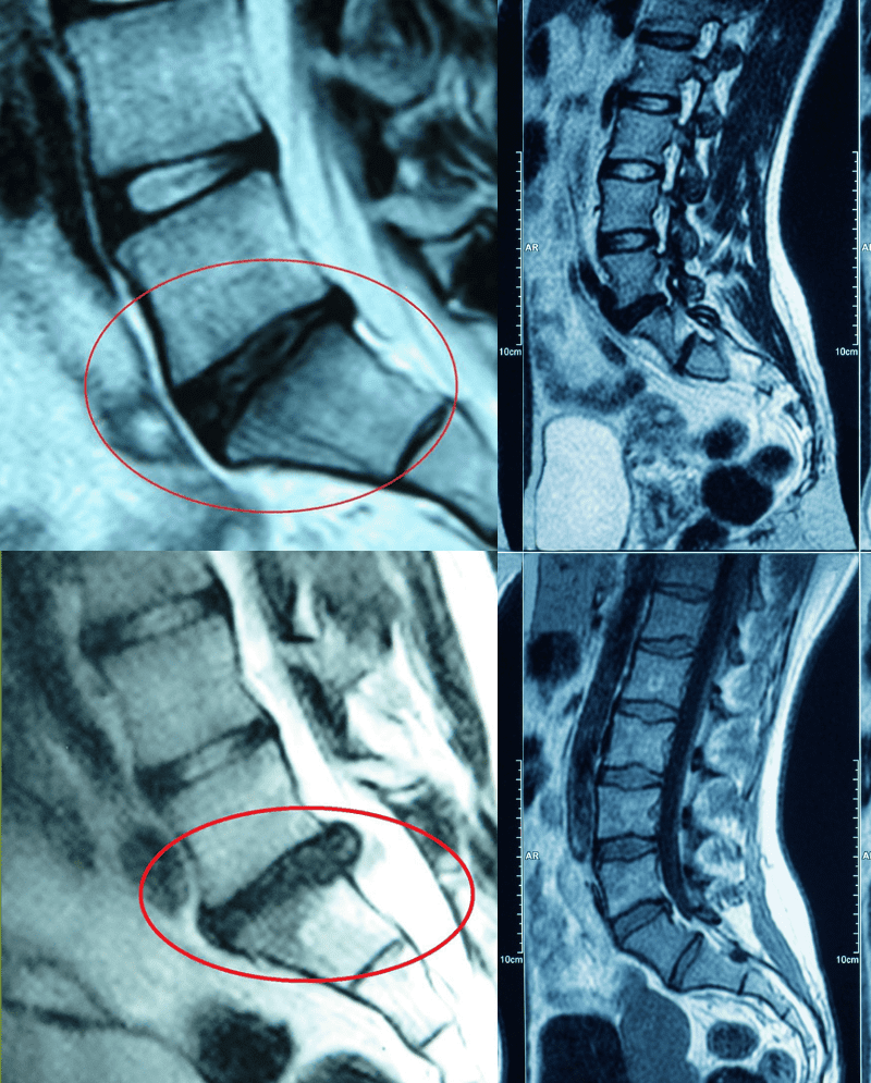 MRI-chiropractor-chester-va