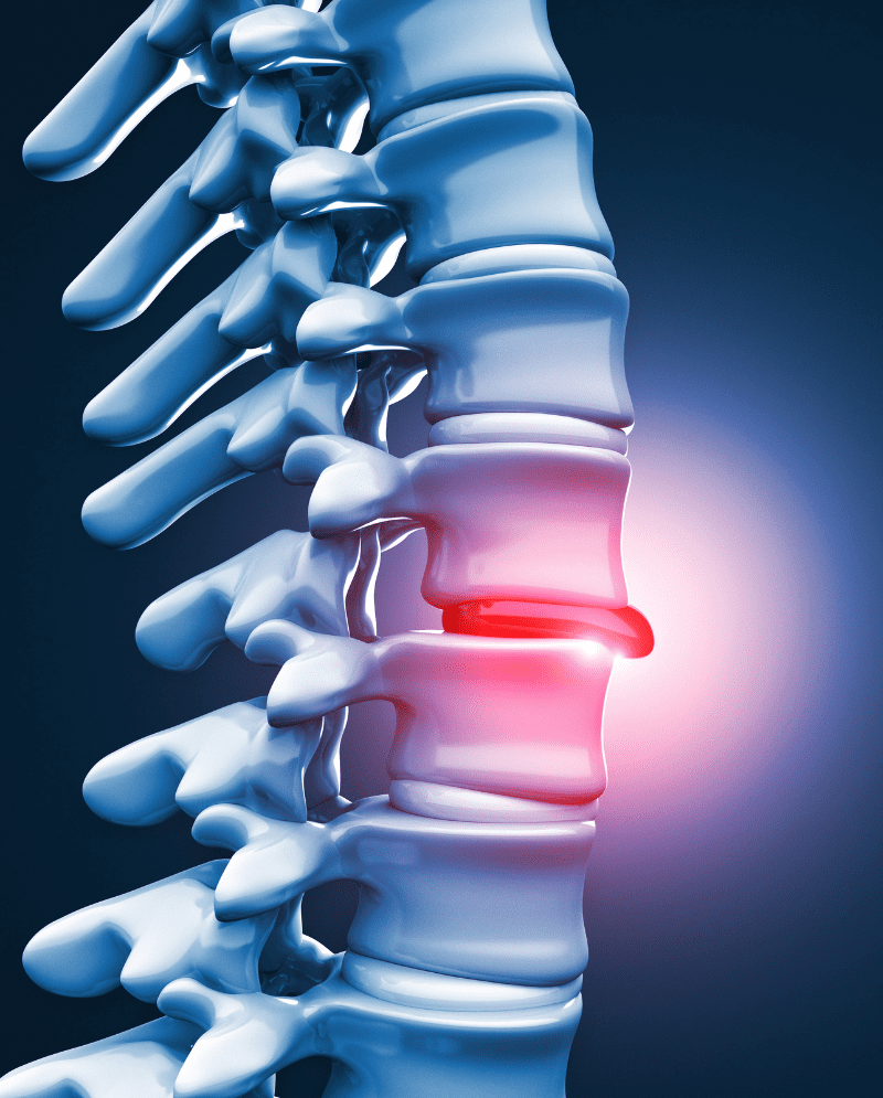 spinal-decompression-chiropractor-chester-va-a